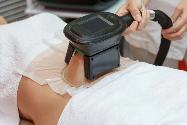 Image of person having fat freezing treatment to help weight gain Wentworth
