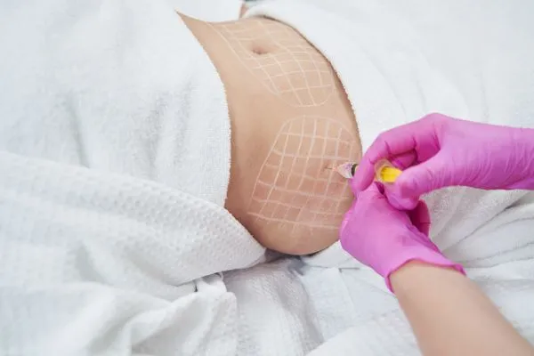 image of fat dissolving injections on love handles to help combat weight gain Wentworth