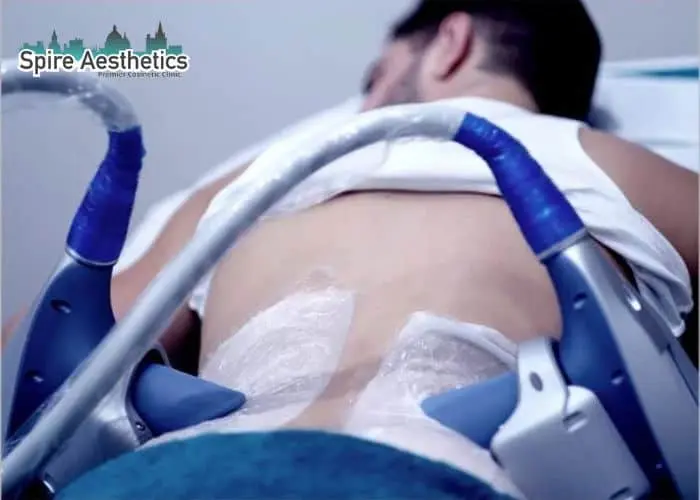 Man having fat freezing treatment done on love handles before a competitions Wentworth to create a sculpted look.