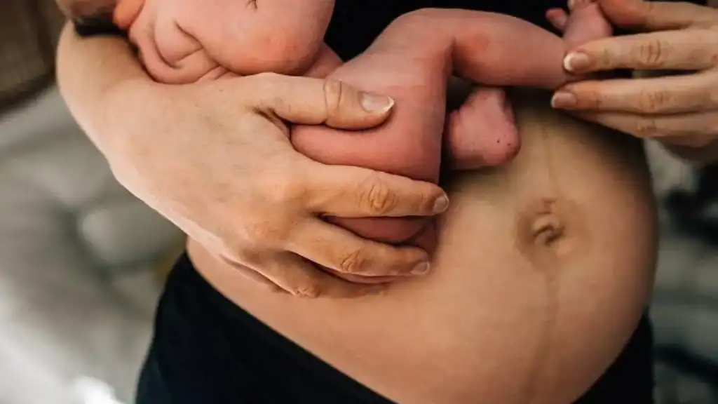Why Is My Stomach Still Big After Pregnancy Wentworth?