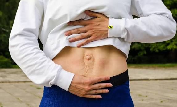 When Could Diastasis Recti Be the Missing Piece of the Puzzle Wentworth?